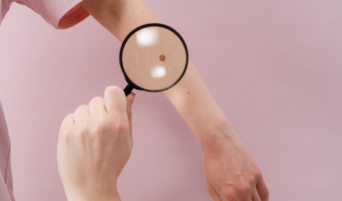 Algemene dermatologie
